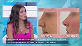 Chirurgia plastica estetica, i benefici della psiche