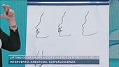 Lifting delle labbra, come averle sempre giovani