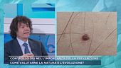 Controllo dei nei, l'importanza della prevenzione