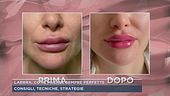 Labbra, come averle sempre perfette