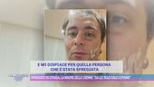 Sfregiato in strada, la madre della 15enne: "Da lei solo calci e pugni"