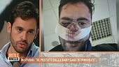 Violenza: "io pestato dalla baby gang di immigrati"