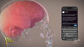Vantaggi e pericoli di Neuralink, l'ultima invenzione di Elon Musk