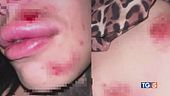 Due amiche transgender aggredite dal branco