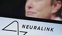 Un microchip nel cervello umano