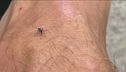 Febbre West Nile, cresce l'allerta