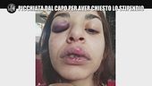 REI: Picchiata dal capo per avere chiesto lo stipendio