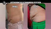 MARTINELLI: Attenzione alla chirurgia estetica