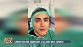 Cambio colore agli occhi, l'allarme dell'esperto