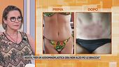 Chirurgia estetica, la storia di Agata