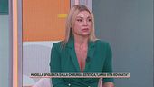 Modella sfigurata dalla chirurgia estetica: "La mia vita rovinata"