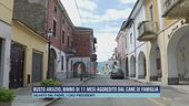 Busto Arsizio, bimbo di 11 mesi aggredito dal cane di famiglia