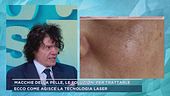 Macchie della pelle, le soluzioni per trattarle