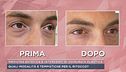 Medicina estetica e interventi di chirurgia plastica