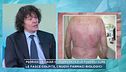 Psoriasi, le cause di insorgenza e le possibili cure