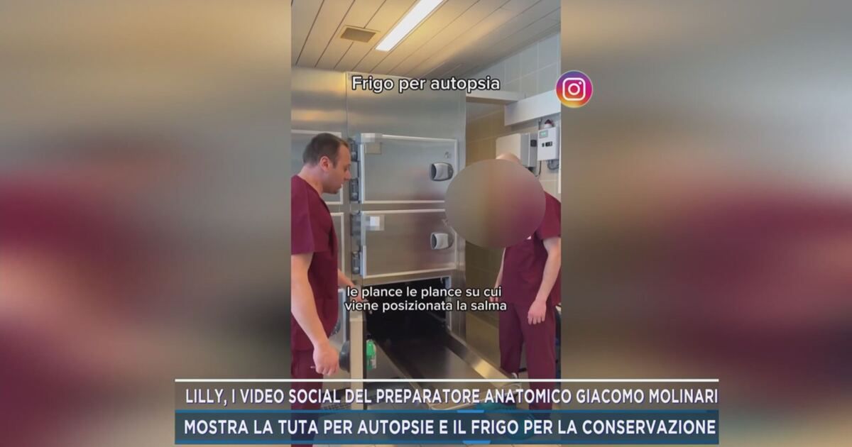 Modelo anatómico de arteria carótida - 3-Dmed - de vena / de la arteria