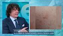 Discromie della pelle, cause e rimedi per le macchie solari