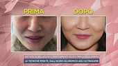Estate in bellezza, i trattamenti giusti per viso e corpo