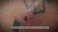 Ragno violino, Vittorio Brumotti morso due volte