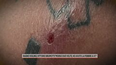 Ragno violino, Vittorio Brumotti morso due volte