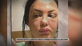 Chirurgia estetica, arrestato medico