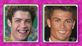 Cristiano Ronaldo e i ritocchini: lo scanner test di "Fatti e rifatti"