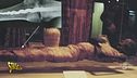 Fantarcheologia: una mummia con la protesi?