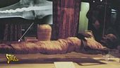 Fantarcheologia: una mummia con la protesi?