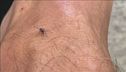 West Nile, casi raddoppiati in 24 ore, 21 a Latina, 32 in Italia