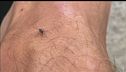 West Nile, casi raddoppiati in 24 ore, 21 a Latina, 32 in Italia