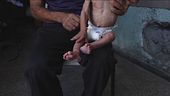 Gaza, 100mila bimbi a rischio morte