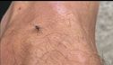 West Nile, "Virus sotto controllo"