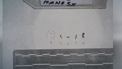 Garlasco, "dna misto e incompleto"