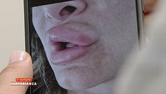 I danni dei finti medici estetici