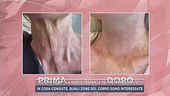"Autumn Reset", la nuova tendenza dei trattamenti estetici