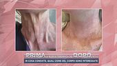 "Autumn Reset", la nuova tendenza dei trattamenti estetici