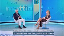Rinoplastica, ecco come rimodellare il naso