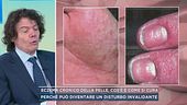 Eczema cronico della pelle, cos'è e come si cura