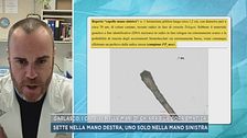 Garlasco, i capelli nelle mani di Chiara e la gora ematica