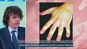 Verruche, cosa sono e come combatterle in modo efficace