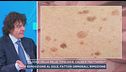 Macchie della pelle, tipologie, cause e trattamenti