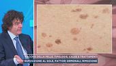 Macchie della pelle, tipologie, cause e trattamenti