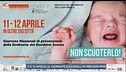 Sindrome del bambino scosso, quali rischi e i segnali