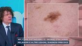 Nei, come distinguerli e i segnali d'allarme