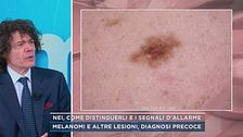 Nei, come distinguerli e i segnali d'allarme