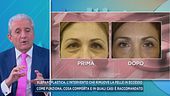 Blefaroplastica, l'intervento che rimuove la pelle in eccesso