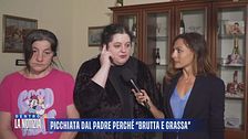 Picchiata dal padre perchè "brutta e grassa"