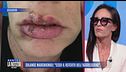 Solange Marchignoli: "Ecco il referto dell'aggressione"