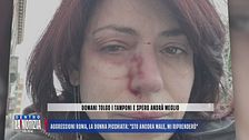 Aggressioni a Roma, la donna picchiata: "Sto ancora male, mi riprenderò"