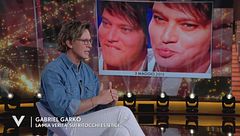Gabriel Garko: "La mia verità sui ritocchi estetici"